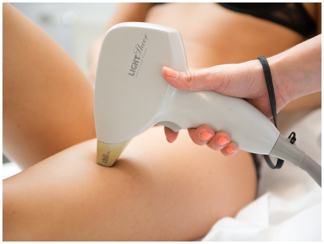 Depilacja laserowa Light Sheer